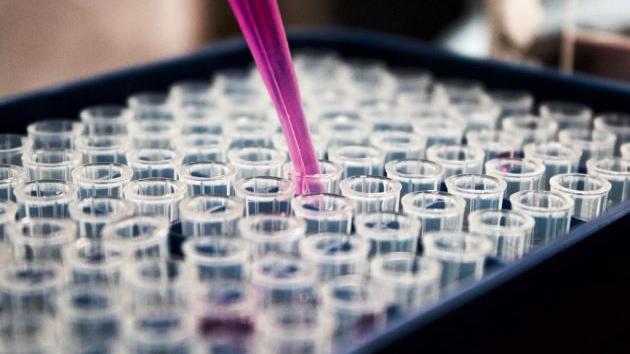 Projekat: Objekat patologije i medicinske citologije opšte bolnice Senta